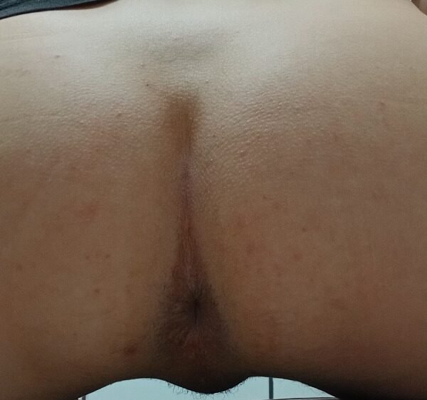 SYMON ANDRET ALVES CAMILO